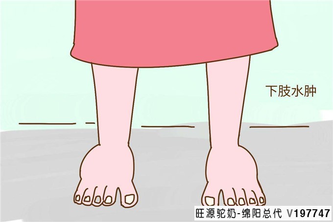 您好,我妈妈腿肿、腹腔有积液,医院检查白蛋白低,可以喝骆驼奶吗?