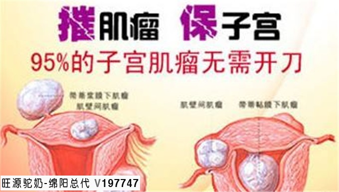 得了子宫肌瘤,为什么先治肝?